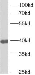 Western Blot ANKRD2 Antibody - BSA Free