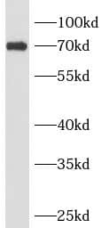 Western Blot ANKRD13B Antibody - BSA Free