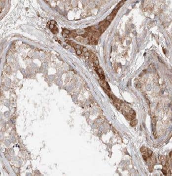 Immunohistochemistry: ANKRD13B Antibody - BSA Free [NBP3-48159] - Immunohistochemistry of paraffin-embedded human testis tissue slide using (ANKRD13B Antibody) at dilution of 1:50
