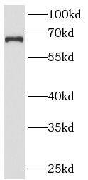 Western Blot: ANKRD13A Antibody - BSA Free [NBP3-48160] - HeLa cells were subjected to SDS PAGE followed by western blot with ANKRD13A(ANKRD13A Antibody) at dilution of 1:300