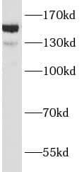 Western Blot: ANKRD11 Antibody - BSA Free [NBP3-48161] - BxPC-3 cells were subjected to SDS PAGE followed by western blot with (ANKRD11 antibody) at dilution of 1:500