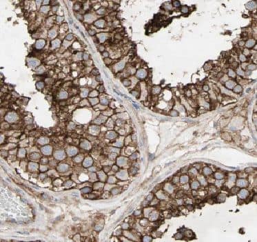 Immunohistochemistry: Archaemetzincin 2 Antibody - BSA Free [NBP3-48164] - Immunohistochemistry of paraffin-embedded human testis using (Archaemetzincin 2 antibody) at dilution of 1:50