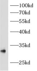 Western Blot: archaemetzincin-1 Antibody - BSA Free [NBP3-48165] - Mouse liver tissue were subjected to SDS PAGE followed by western blot with (archaemetzincin-1 Antibody) at dilution of 1:1000