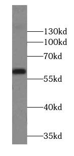 Western Blot Pancreatic Amylase Beta Antibody - BSA Free