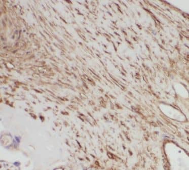 Immunohistochemistry: PRKAG2 Antibody - BSA Free [NBP3-48167] - Immunohistochemistry of paraffin-embedded human placenta tissue slide using (PRKAG2 Antibody) at dilution of 1:50