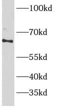 Western Blot: PRKAG2 Antibody - BSA Free [NBP3-48167] - Mouse heart tissue were subjected to SDS PAGE followed by western blot with (PRKAG2 Antibody) at dilution of 1:600