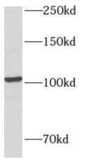 Western Blot: AMPD2 Antibody - BSA Free [NBP3-48168] - Human liver tissue were subjected to SDS PAGE followed by western blot with (AMPD2 antibody) at dilution of 1:500