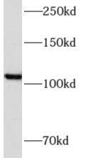 Western Blot: Angiomotin like 1 Antibody - BSA Free [NBP3-48170] - HeLa cells were subjected to SDS PAGE followed by western blot with (Angiomotin like 1 antibody) at dilution of 1:500