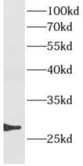 Western Blot: AMN1 Antibody - BSA Free [NBP3-48171] - Human colon tissue were subjected to SDS PAGE followed by western blot with (AMN1 antibody) at dilution of 1:400