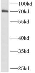Western Blot ALX3 Antibody - BSA Free