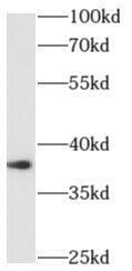 Western Blot: CART1 Antibody - BSA Free [NBP3-48174] - Mouse embryo tissue were subjected to SDS PAGE followed by western blot with (CART1 Antibody) at dilution of 1:600