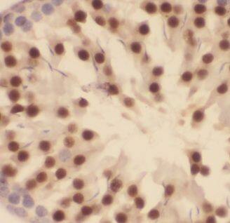 Immunohistochemistry: ALS2CR8 Antibody - BSA Free [NBP3-48175] - Immunohistochemistry of paraffin-embedded human testis tissue slide using (ALS2CR8 Antibody) at dilution of 1:50