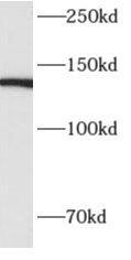 Western Blot ALPK1 Antibody - BSA Free