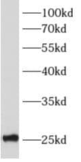Western Blot: ALKBH7 Antibody - BSA Free [NBP3-48179] - Human testis tissue were subjected to SDS PAGE followed by western blot with (ALKBH7 antibody) at dilution of 1:500