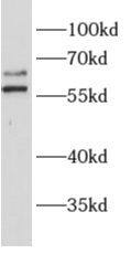 Western Blot ALG6 Antibody - BSA Free