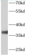 Western Blot ALG5 Antibody - BSA Free