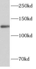 Western Blot ALG13 Antibody - BSA Free