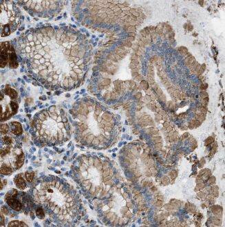 Immunohistochemistry ALG13 Antibody - BSA Free