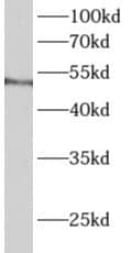 Western Blot: ALDH3B1 Antibody - BSA Free [NBP3-48185] - RAW 264.7 cells were subjected to SDS PAGE followed by western blot with (ALDH3B1 Antibody) at dilution of 1:300