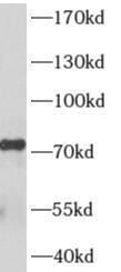 Western Blot: HA95/AKAP8L Antibody - BSA Free [NBP3-48189] - PC-3 cells were subjected to SDS PAGE followed by western blot with (HA95/AKAP8L Antibody) at dilution of 1:300