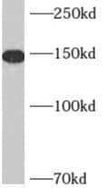 Western Blot: AKAP1 Antibody - BSA Free [NBP3-48191] - HeLa cells were subjected to SDS PAGE followed by western blot with (AKAP1 antibody) at dilution of 1:1000