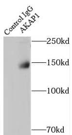 Immunoprecipitation: AKAP1 Antibody - BSA Free [NBP3-48191] - IP Result of anti-AKAP1 (IP:, 4ug; Detection: 1:2000) with PC-3 cells lysate 1800ug.