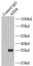 Immunoprecipitation: AIDA Antibody - BSA Free [NBP3-48194] - IP Result of anti-AIDA (IP:, 3ug; Detection: 1:600) with HeLa cells lysate 4000ug.
