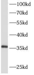 Western Blot: AIDA Antibody - BSA Free [NBP3-48194] - HEK-293 cells were subjected to SDS PAGE followed by western blot with (AIDA Antibody) at dilution of 1:600
