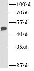 Western Blot: AGPAT9 Antibody - BSA Free [NBP3-48198] - Rat kidney tissue were subjected to SDS PAGE followed by western blot with (AGPAT9 Antibody) at dilution of 1:1500