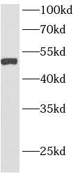 Western Blot AGPAT6 Antibody - BSA Free