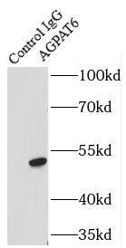 Immunoprecipitation AGPAT6 Antibody - BSA Free