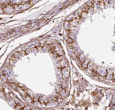 Immunohistochemistry AGPAT6 Antibody - BSA Free