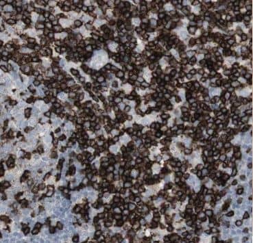 Immunohistochemistry AGFG2 Antibody - BSA Free