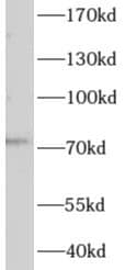 Western Blot: CBCP3 Antibody - BSA Free [NBP3-48203] - Mouse liver tissue were subjected to SDS PAGE followed by western blot with (CBCP3 Antibody) at dilution of 1:300