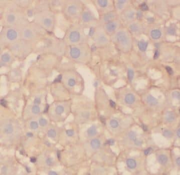 Immunohistochemistry: ADPGK Antibody - BSA Free [NBP3-48207] - Immunohistochemistry of paraffin-embedded human liver using (ADPGK antibody) at dilution of 1:50