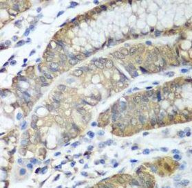Immunohistochemistry: alcohol dehydrogenase 1C Antibody - BSA Free [NBP3-48211] - Immunohistochemistry of paraffin-embedded human stomach tissue slide using with (alcohol dehydrogenase 1C antibody) at dilution of 1:100