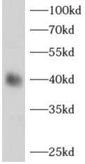 Western Blot: alcohol dehydrogenase 1B Antibody - BSA Free [NBP3-48212] - Mouse liver tissue were subjected to SDS PAGE followed by western blot with (alcohol dehydrogenase 1B Antibody) at dilution of 1:1000