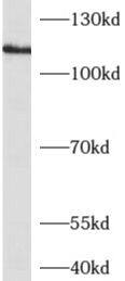 Western Blot: Adenylate Cyclase 1 Antibody - BSA Free [NBP3-48214] - Y79 cells were subjected to SDS PAGE followed by western blot with (Adenylate Cyclase 1 antibody) at dilution of 1:500