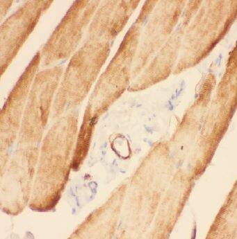 Immunohistochemistry: ADAMTSL4 Antibody - BSA Free [NBP3-48219] - Immunohistochemistry of paraffin-embedded human skeletal muscle tissue slide using (ADAMTSL4 Antibody) at dilution of 1:50