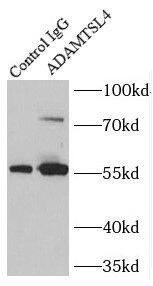 Immunoprecipitation: ADAMTSL4 Antibody - BSA Free [NBP3-48219] - IP Result of anti-ADAMTSL4 (IP:, 4ug; Detection: 1:500) with mouse brain tissue lysate 3440ug.