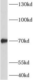 Western Blot ADAMTSL4 Antibody - BSA Free