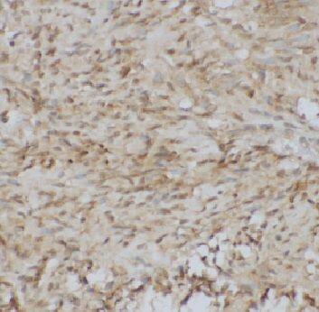 Immunohistochemistry ADAMTS12 Antibody - BSA Free