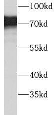Western Blot: ACSS1 Antibody - BSA Free [NBP3-48226] - Mouse kidney tissue were subjected to SDS PAGE followed by western blot with (ACSS1 antibody) at dilution of 1:3000