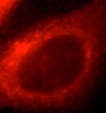 Immunocytochemistry/ Immunofluorescence ACSM3 Antibody - BSA Free