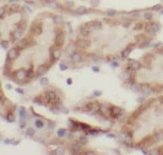 Immunohistochemistry ACSM3 Antibody - BSA Free