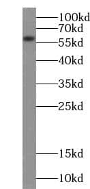 Western Blot ACSM3 Antibody - BSA Free