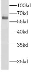 Western Blot: ACSM2A Antibody - BSA Free [NBP3-48229] - Human brain tissue were subjected to SDS PAGE followed by western blot with (ACSM2A antibody) at dilution of 1:1000
