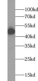 Western Blot: ACP2 Antibody - BSA Free [NBP3-48232] - Mouse kidney tissue were subjected to SDS PAGE followed by western blot with (ACP2 antibody) at dilution of 1:500