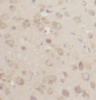 Immunohistochemistry: ACOT7 Antibody - BSA Free [NBP3-48233] - Immunohistochemistry of paraffin-embedded human brain using (ACOT7 antibody) at dilution of 1:100