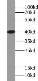 Western Blot: ACOT7 Antibody - BSA Free [NBP3-48233] - Mouse brain tissue were subjected to SDS PAGE followed by western blot with (ACOT7 antibody) at dilution of 1:5000